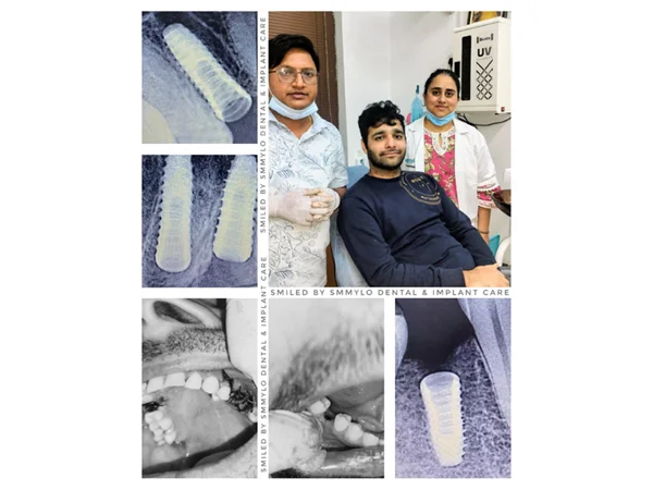 Treatments