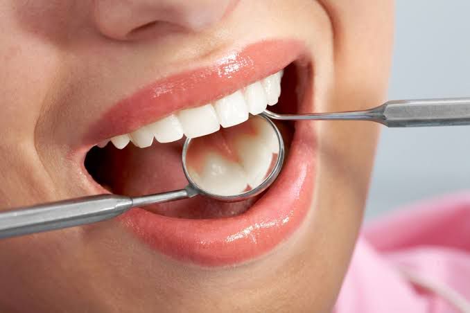 Routine Dental Check Ups and Consultations