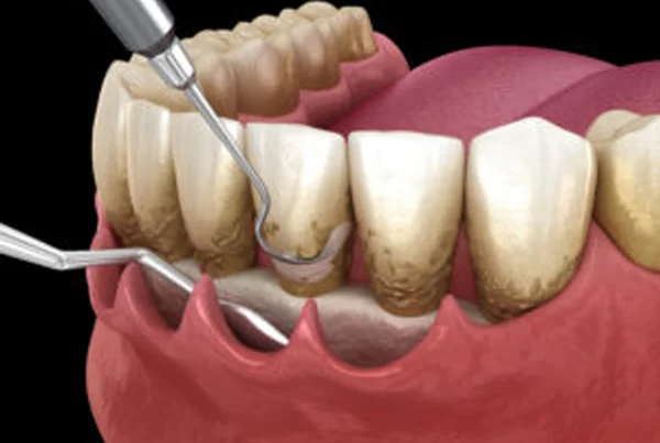 General Dentistry