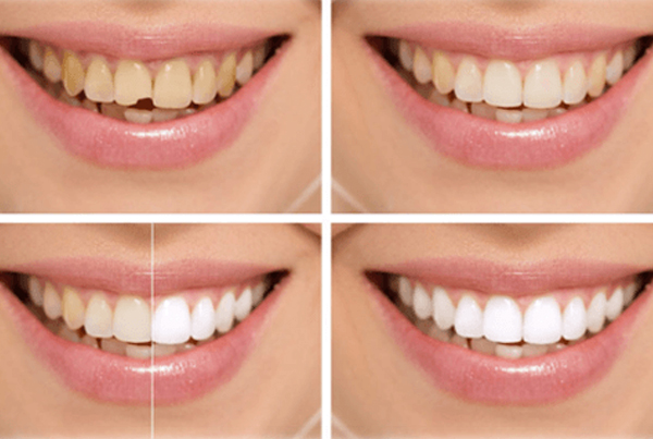 Cosmetic Dentistry