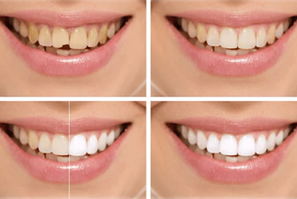 Cosmetic Dentistry