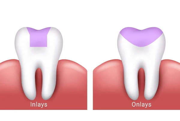 Restorative Dentistry