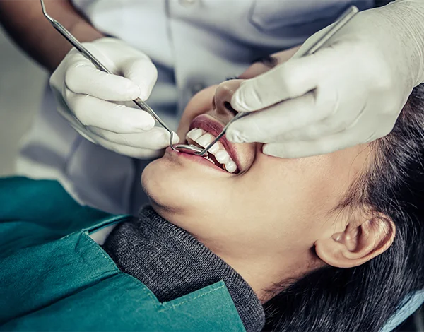 Laser Gum Reshaping