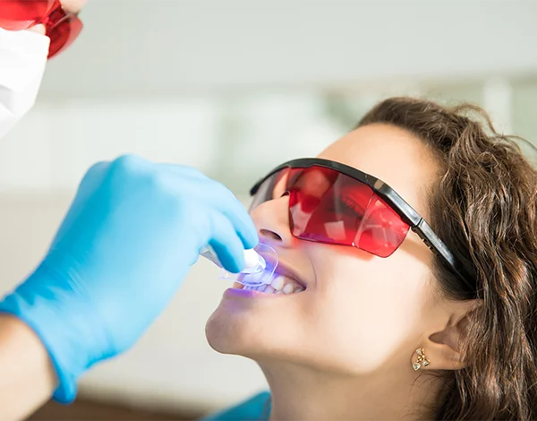 Laser Teeth Whitening
